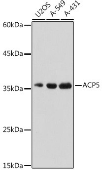 Tartrate Resistant Acid Phosphatase Antibody in Western Blot (WB)