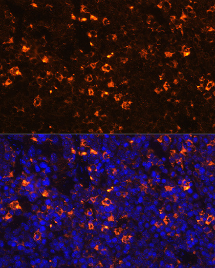 CLEC4D Antibody in Immunohistochemistry (Paraffin) (IHC (P))