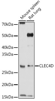 CLEC4D Antibody in Western Blot (WB)