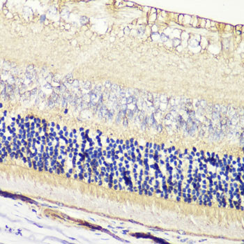 GRK1 Antibody in Immunohistochemistry (Paraffin) (IHC (P))