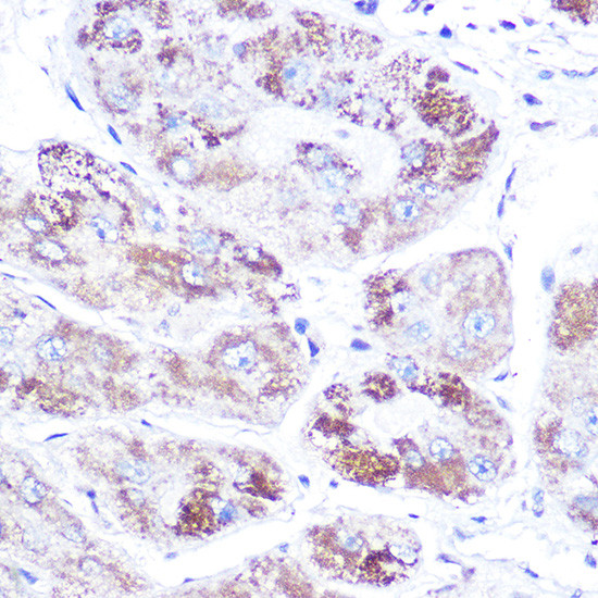 NR3C2 Antibody in Immunohistochemistry (Paraffin) (IHC (P))