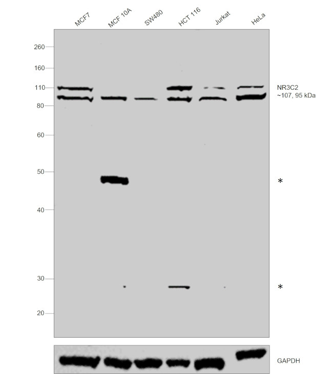 NR3C2 Antibody in Western Blot (WB)