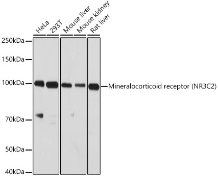 NR3C2 Antibody in Western Blot (WB)