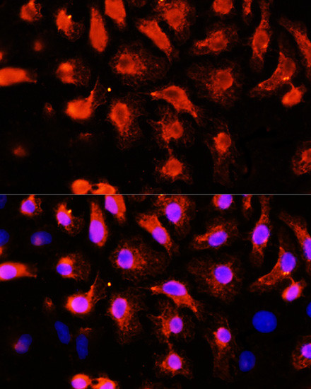 alpha Actinin 2 Antibody in Immunocytochemistry (ICC/IF)