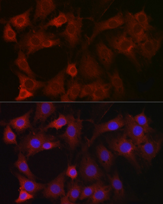 eIF4E2 Antibody in Immunocytochemistry (ICC/IF)