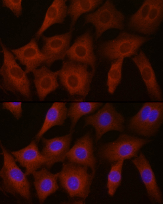 eIF4E2 Antibody in Immunocytochemistry (ICC/IF)