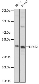 eIF4E2 Antibody in Western Blot (WB)