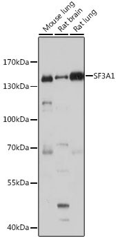 SF3A1 Antibody in Western Blot (WB)