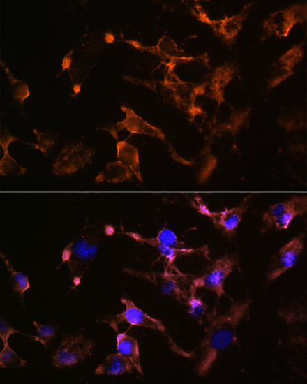 Amphiphysin Antibody in Immunocytochemistry (ICC/IF)