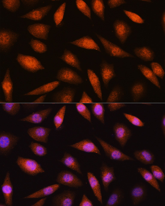 LIMK2 Antibody in Immunocytochemistry (ICC/IF)