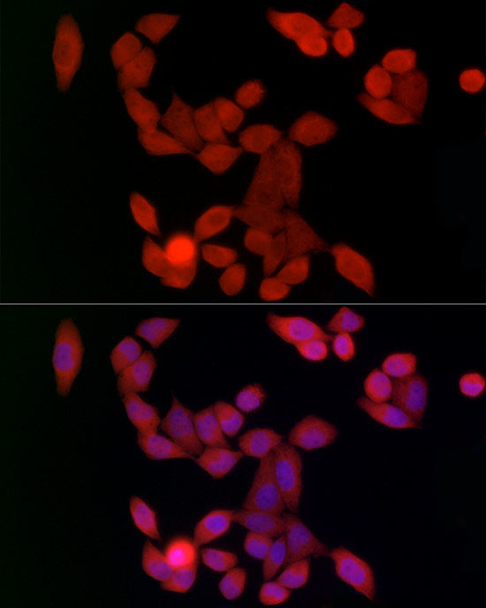 UBE2C Antibody in Immunocytochemistry (ICC/IF)