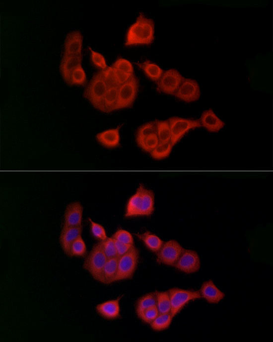 UBE2C Antibody in Immunocytochemistry (ICC/IF)