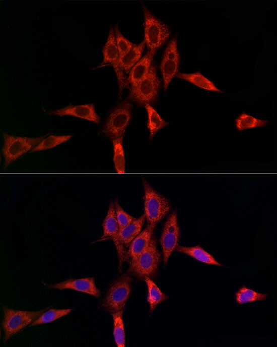 UBE2C Antibody in Immunocytochemistry (ICC/IF)