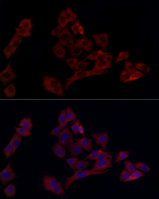 UBE2C Antibody in Immunocytochemistry (ICC/IF)