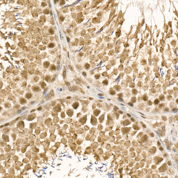 UBE2C Antibody in Immunohistochemistry (Paraffin) (IHC (P))