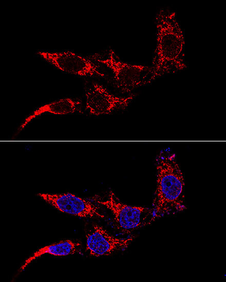 FIS1 Antibody in Immunocytochemistry (ICC/IF)