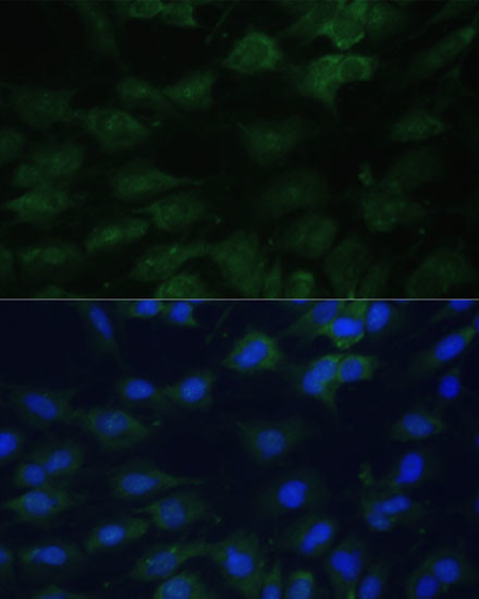 eIF1AX Antibody in Immunocytochemistry (ICC/IF)