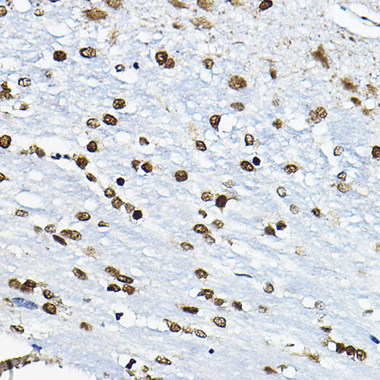 CIRBP Antibody in Immunohistochemistry (Paraffin) (IHC (P))