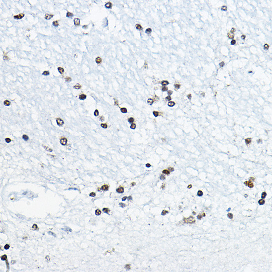 CIRBP Antibody in Immunohistochemistry (Paraffin) (IHC (P))