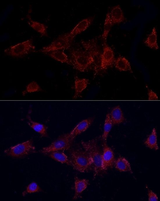 MMP2 Antibody in Immunocytochemistry (ICC/IF)