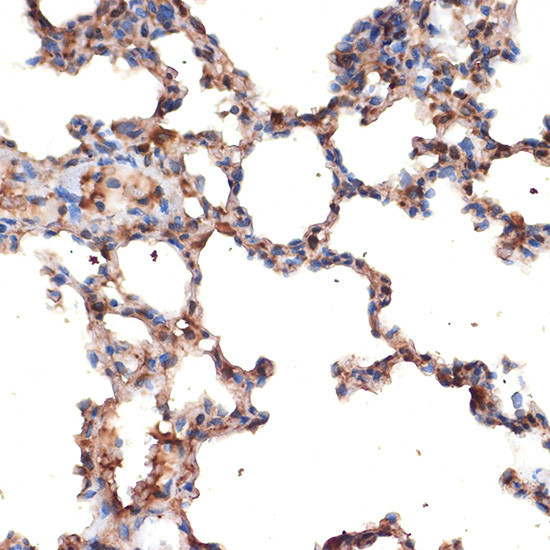 MMP2 Antibody in Immunohistochemistry (Paraffin) (IHC (P))