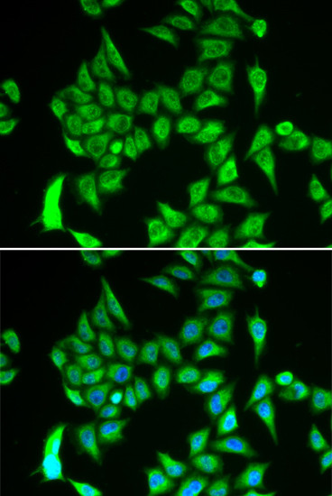 IREB2 Antibody in Immunocytochemistry (ICC/IF)