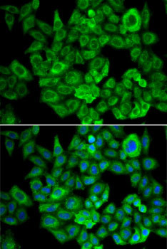 OGDH Antibody in Immunocytochemistry (ICC/IF)