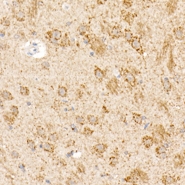 OGDH Antibody in Immunohistochemistry (Paraffin) (IHC (P))