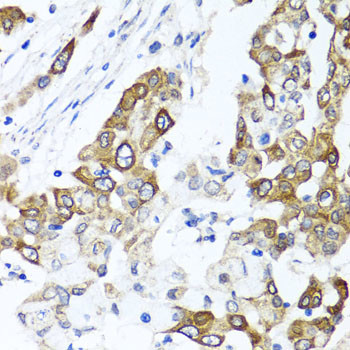 PPOX Antibody in Immunohistochemistry (Paraffin) (IHC (P))