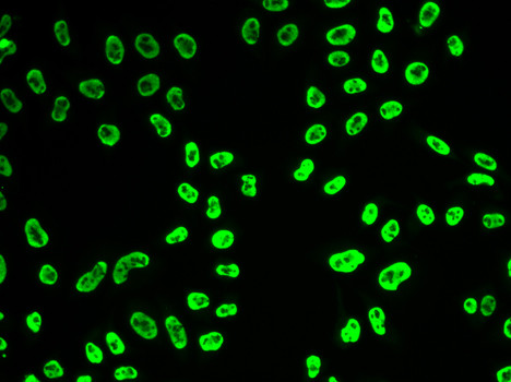 SNRPA Antibody in Immunocytochemistry (ICC/IF)