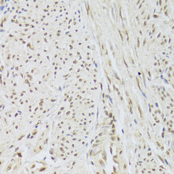 SNRPA Antibody in Immunohistochemistry (Paraffin) (IHC (P))