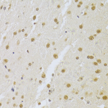 SNRPA Antibody in Immunohistochemistry (Paraffin) (IHC (P))