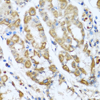 CMG2 Antibody in Immunohistochemistry (Paraffin) (IHC (P))