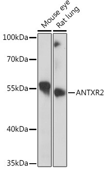 CMG2 Antibody in Western Blot (WB)