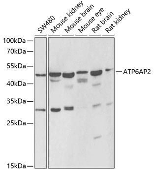 ATP6IP2 Antibody in Western Blot (WB)