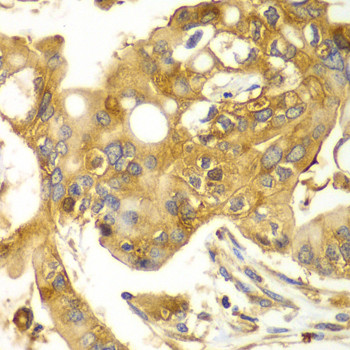 Calpain S1 Antibody in Immunohistochemistry (Paraffin) (IHC (P))