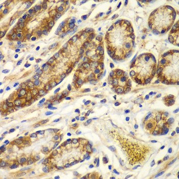 Calpain S1 Antibody in Immunohistochemistry (Paraffin) (IHC (P))