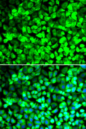 eIF5 Antibody in Immunocytochemistry (ICC/IF)