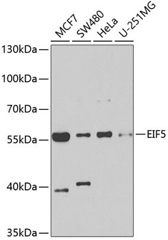 eIF5 Antibody in Western Blot (WB)