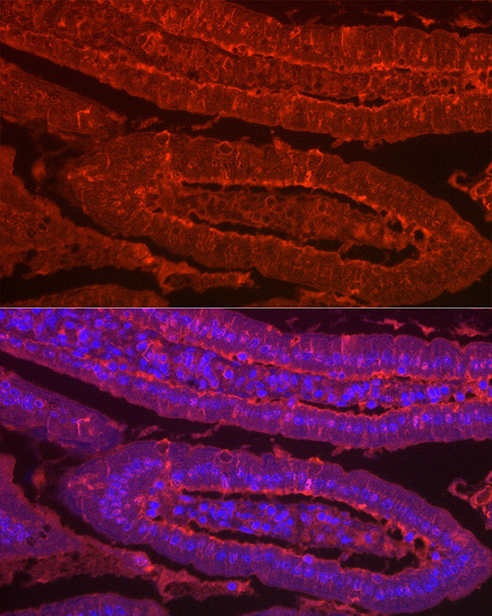 Galectin 2 Antibody in Immunohistochemistry (Paraffin) (IHC (P))