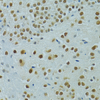 MUS81 Antibody in Immunohistochemistry (Paraffin) (IHC (P))