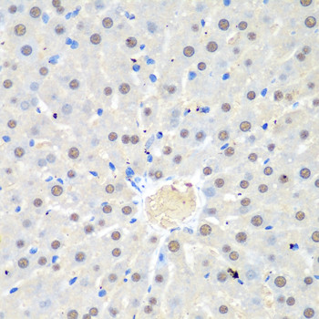 WDR48 Antibody in Immunohistochemistry (Paraffin) (IHC (P))