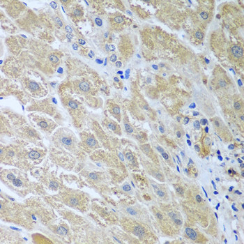 WDR48 Antibody in Immunohistochemistry (Paraffin) (IHC (P))