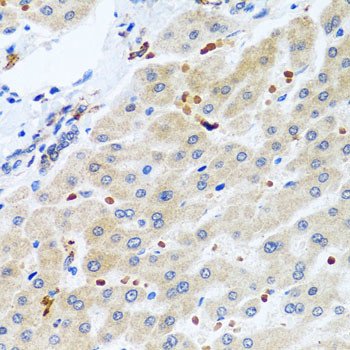 RGS5 Antibody in Immunohistochemistry (Paraffin) (IHC (P))