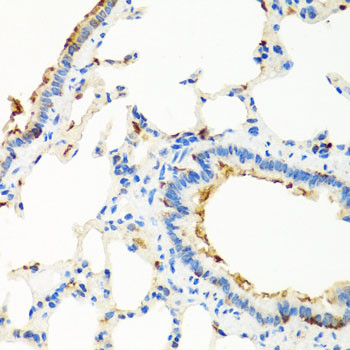 RGS5 Antibody in Immunohistochemistry (Paraffin) (IHC (P))