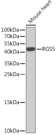 RGS5 Antibody in Western Blot (WB)