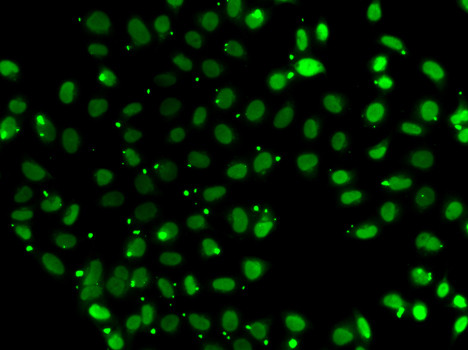 PC4 Antibody in Immunocytochemistry (ICC/IF)