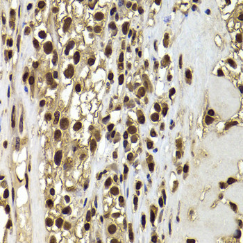 BAF53B Antibody in Immunohistochemistry (Paraffin) (IHC (P))