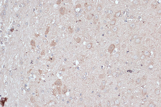 LC3B Antibody in Immunohistochemistry (Paraffin) (IHC (P))