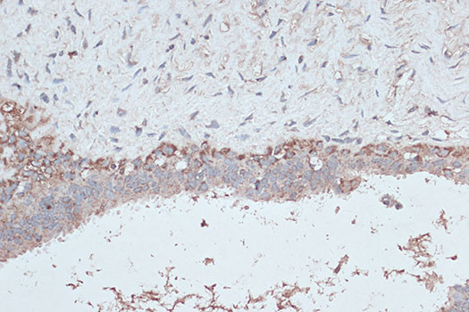 LC3B Antibody in Immunohistochemistry (Paraffin) (IHC (P))